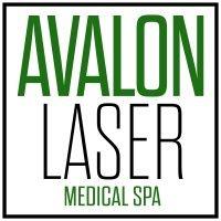 avalon laser logo image