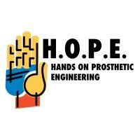 hands on prosthetic engineering (hope)