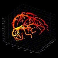 uc davis department of neurology