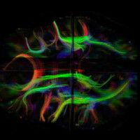 mind laboratory (music, imaging, and neural dynamics)